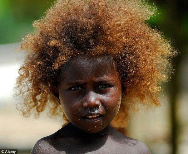 How Common Did Red Hair With Black Skin Used To Be? - Quora